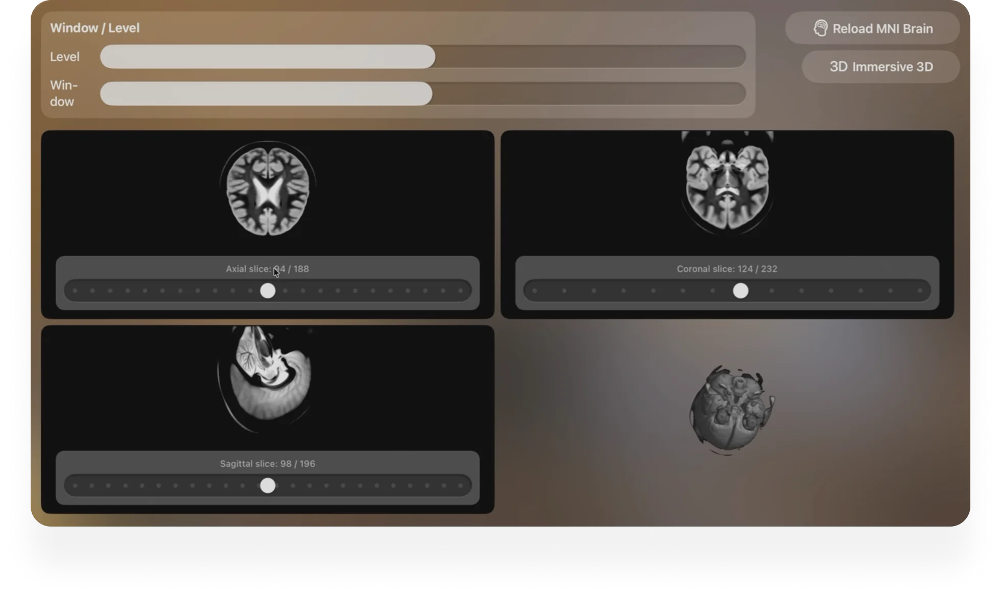 VR medical scan viewer interface