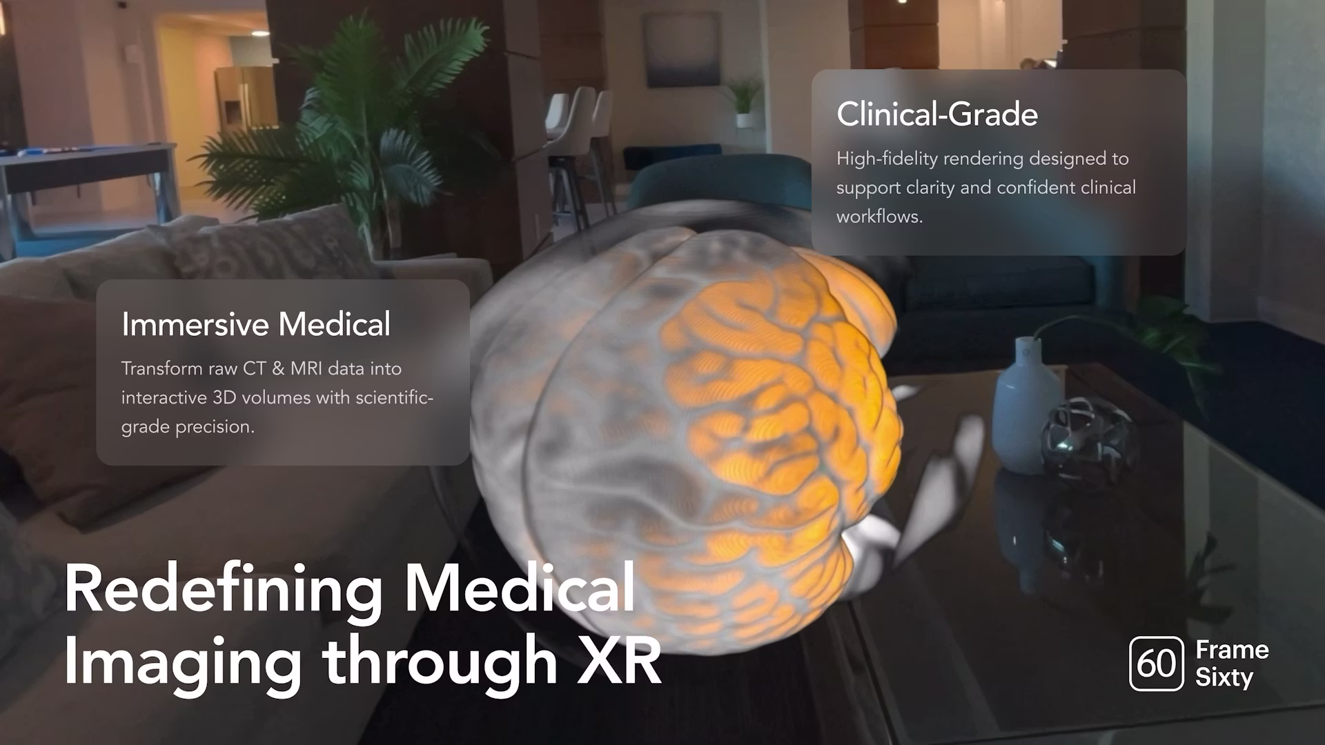 Real-Time 3D MRI & CT Spatial Rendering on Vision Pro